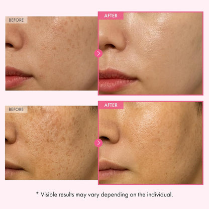 Alpha Arbutin + TXA Cream