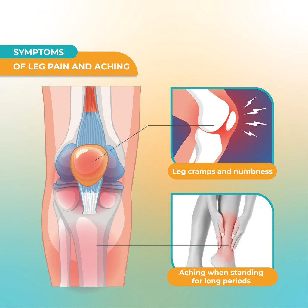 Compression Stockings For Varicose Veins