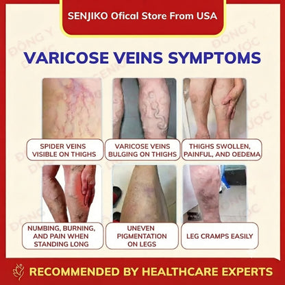 Senjoko Japanese Leg Varicose Vein Cream, Reduces swelling and soreness, supports blood circulation, and alleviates leg edema and heaviness.