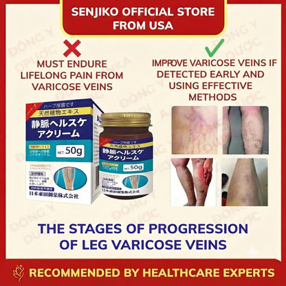 Senjoko Japanese Leg Varicose Vein Cream, Reduces swelling and soreness, supports blood circulation, and alleviates leg edema and heaviness.