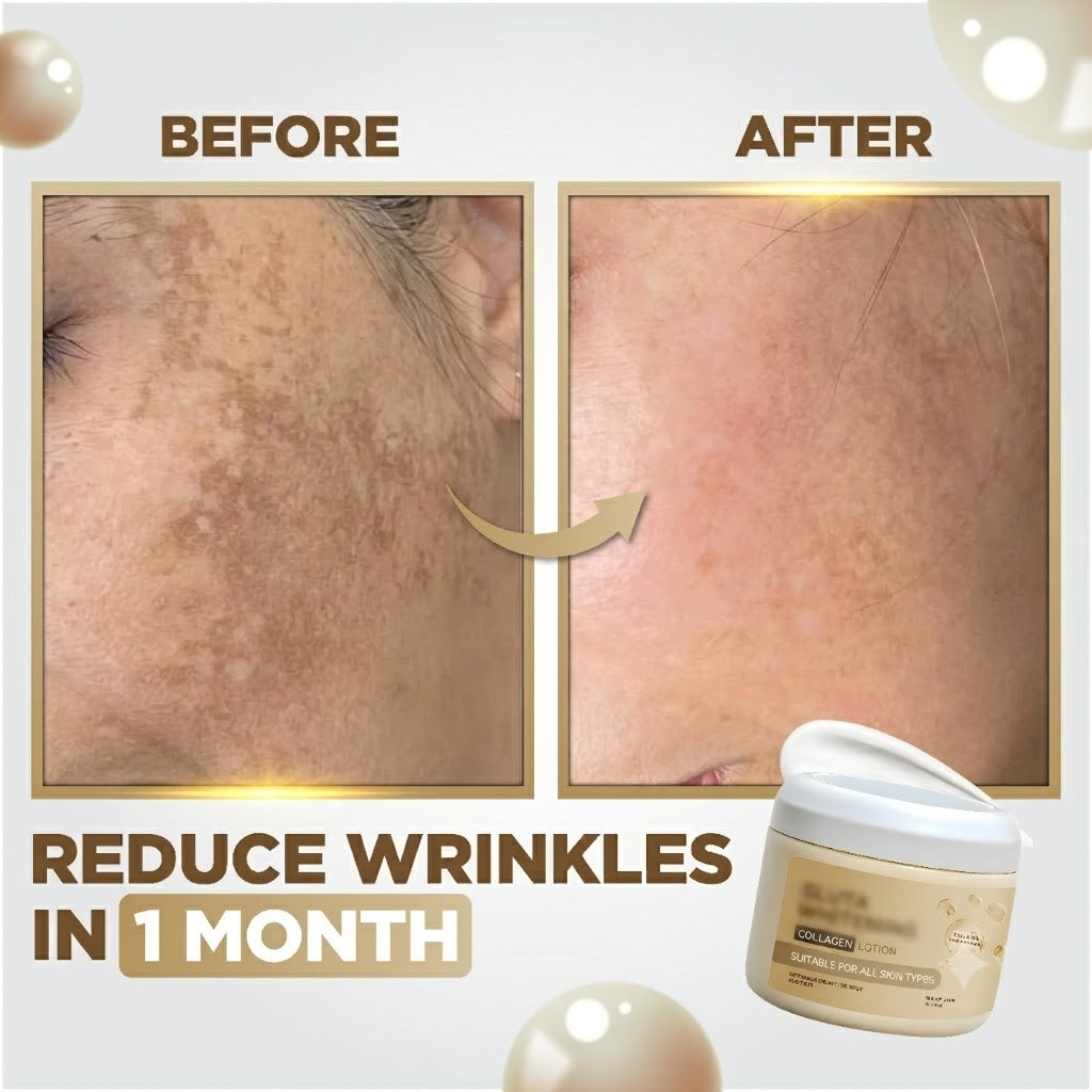 Whitening And Dark Spot Treatment Cream