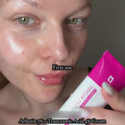 Alpha Arbutin + TXA Cream