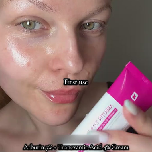 Alpha Arbutin + TXA Cream